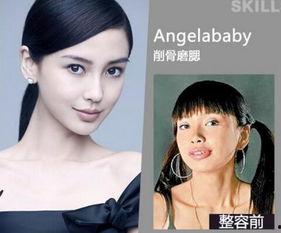 成都整容爆料案件最新,揭开医美行业潜规则与维权困境