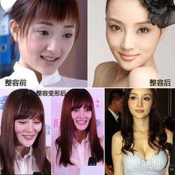 成都整容爆料案件最新,揭开医美行业潜规则与维权困境  第2张