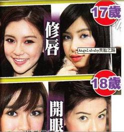 成都整容爆料案件最新,揭开医美行业潜规则与维权困境  第3张